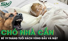 Chó nhà cắn, bé 19 tháng tuổi rách sâu vùng đầu và mặt phải cấp cứu