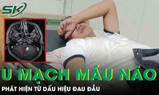 Nam thanh niên phát hiện u mạch máu não xuất huyết từ dấu hiệu đau đầu