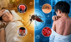 Đừng xem nhẹ những cơn sốt mùa hè