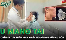 Phẫu thuật u tuyến mang tai chèn ép dây thần kinh, trả lại nụ cười cho người phụ nữ 52 tuổi