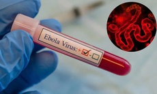 WHO cảnh báo khẩn về Ebola, Bộ Y tế yêu cầu tăng cường giám sát, ngăn dịch xâm nhập