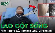 Đau lưng kéo dài nhưng chủ quan, người đàn ông bất ngờ liệt hai chân vì lao cột sống