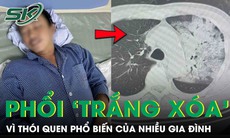 Tưởng cảm cúm, người đàn ông bất ngờ suy đa tạng, phổi ‘trắng xoá’ vì thói quen nhiều người mắc