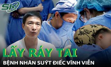 Tự lấy ráy tai tại nhà, bệnh nhân suýt điếc vĩnh viễn