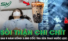 Uống 3.000 cốc trà sữa thay nước lọc suốt 9 năm, thận cô gái mọc chi chít sỏi