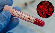 Dịch bệnh Ebola diễn biến phức tạp tại Châu Phi nhưng người dân không nên hoang mang