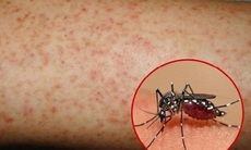 Hơn 1.100 ca mắc sốt xuất huyết, Lâm Đồng kích hoạt các biện pháp phòng, chống dịch