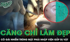 Căng chỉ làm đẹp tại spa cô gái trẻ nhiễm trùng mặt phải nhập viện gắp dị vật