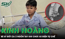 Kinh hoàng: Bé trai 5 tuổi đứt lìa 2 ngón tay khi chơi xe điện tự chế