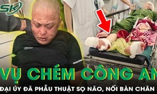 Đại úy công an bị chém tại trụ sở đã được nối lại bàn chân và phẫu thuật sọ não