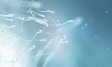 Tinh dịch loãng có gây vô sinh không?