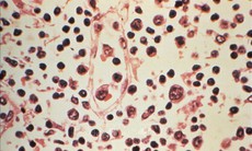 Đài Loan (Trung Quốc) ghi nhận 1 ca tử vong do nhiễm virus Hanta
