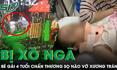 Bé gái 4 tuổi bị bạn xô ngã từ cầu trượt cao 1,5m chấn thương sọ não vỡ xương trán