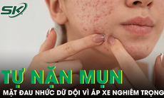 Tự nặn mụn quanh môi, cô gái nhập viện vì áp xe mặt, nhiễm vi khuẩn kháng thuốc