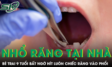 Được mẹ nhổ răng tại nhà, bé trai 9 tuổi bất ngờ hít luôn chiếc răng vào phổi
