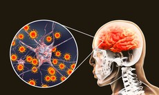 Hà Nội ghi nhận ca viêm não Nhật Bản, bác sĩ khuyến cáo cách phòng bệnh hiệu quả