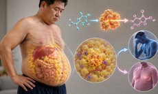 Vì sao đàn ông dễ béo bụng sau tuổi 35?