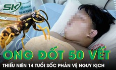 Bị ong vò vẽ đốt hơn 50 vết, thiếu niên 14 tuổi hoại tử, sốc phản vệ nguy kịch