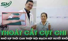 Thoát nguy cơ cắt cụt chi nhờ can thiệp nội mạch hút huyết khối 