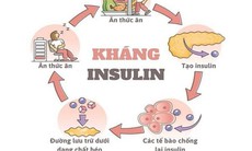 Omega-7 có giúp cải thiện đề kháng insulin và sức khỏe chuyển hóa?