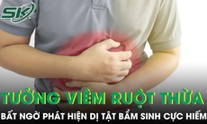 Đau bụng tưởng viêm ruột thừa cấp, bất ngờ phát hiện mắc dị tật bẩm sinh chỉ 2% người mắc 