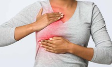 Đau tuyến vú ở tuổi mãn kinh có nguy hiểm không?