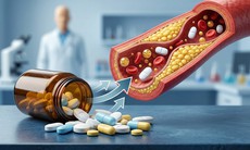 6 loại thuốc có thể gây tăng lipid máu cần lưu ý khi sử dụng