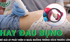 Nhiều lần đau bụng thoáng qua, bé gái 6 tuổi phát hiện u quái buồng trứng kích thước lớn