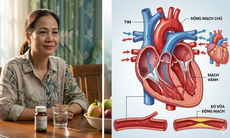 Mãn kinh sớm làm tăng 40% nguy cơ mắc bệnh tim mạch suốt đời