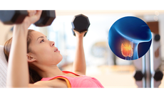 Người mắc bệnh tuyến giáp có nên tập thể dục không?