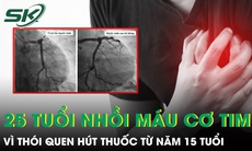 Hút thuốc từ năm 15 tuổi, nam thanh niên 25 tuổi bất ngờ nhồi máu cơ tim 