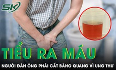 Chủ quan tiểu ra máu nhiều năm, người đàn ông phải cắt bàng quang vì ung thư