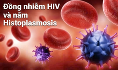 Đồng nhiễm HIV và nấm Histoplasmosis: Phát hiện sớm để giảm nguy cơ tổn thương phổi và tử vong