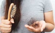 6 nhóm vi chất cần bổ sung ngay để tránh rụng tóc