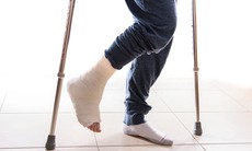 Lưu ý khi phục hồi chức năng sau gãy xương