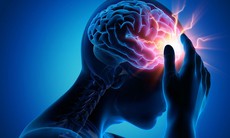Thiếu máu não thoáng qua có thể là dấu hiệu báo trước nguy cơ đột quỵ
