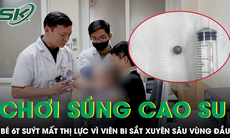 Chơi súng cao su với anh, bé 6 tuổi suýt mất thị lực vì viên bi sắt xuyên sâu vùng đầu