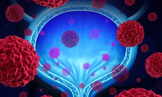FDA bật đèn xanh cho phác đồ đột phá điều trị ung thư bàng quang mới