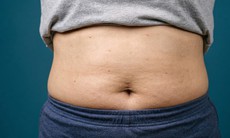 6 thói quen khiến vòng eo mãi không thon gọn