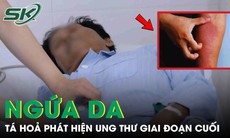 Tá hỏa phát hiện ung thư tuỵ giai đoạn cuối từ dấu hiệu ngứa da