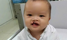 Bé trai 8 tháng tuổi bị bỏ rơi trước cổng chùa cần trợ giúp để phẫu thuật dị tật