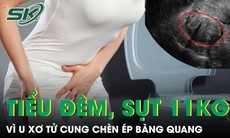 Người phụ nữ tiểu đêm liên tục, sụt 11kg vì khối u xơ tử cung chèn ép bàng quang