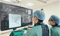 Đau đầu kéo dài cảnh giác với túi phình động mạch não nguy hiểm
