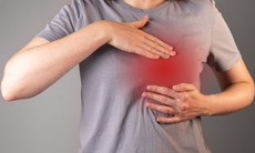 4 dấu hiệu bất thường cảnh báo ung thư vú