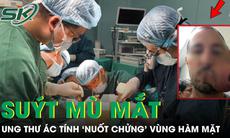 Người đàn ông 76 tuổi suýt mù mắt vì ung thư ác tính ‘nuốt chửng’ vùng hàm mặt