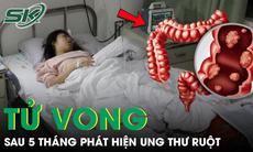 Cô gái 26 tuổi tử vong sau 5 tháng phát hiện ung thư ruột từ triệu chứng đau bụng