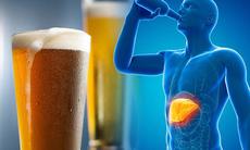Ngoài hạn chế rượu bia, những thói quen nào giúp phòng bệnh gan hiệu quả? 