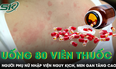 Tự uống 80 viên thuốc trị ký sinh trùng, người phụ nữ nhập viện nguy kịch, men gan tăng cao