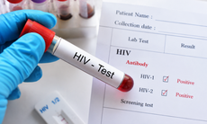 HIV có thể được phát hiện sớm như thế nào? Hiểu đúng ‘thời kỳ cửa sổ’ để không bỏ lỡ thời điểm xét nghiệm