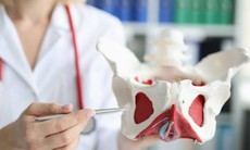 4 thói quen hàng ngày âm thầm làm suy yếu cơ sàn chậu, nhiều người vẫn mắc phải